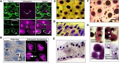 Anthocyanic Vacuolar Inclusions: From Biosynthesis to Storage and Possible Applications